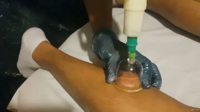 Professional Hijama Cupping Therapy Certificate Full Course - Screenshot_01