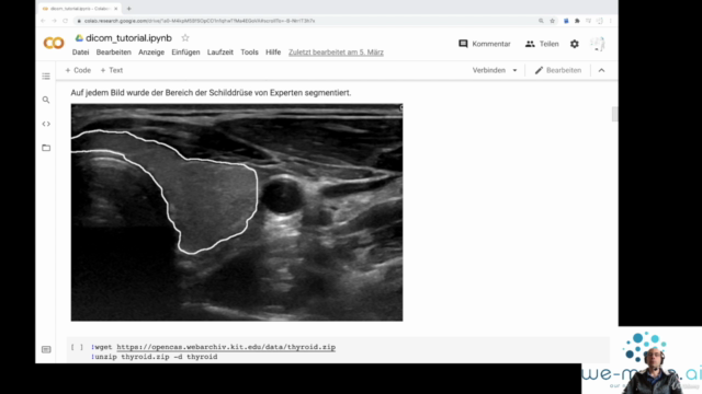 Deep Learning & künstliche Intelligenz in der Medizin fastai - Screenshot_02