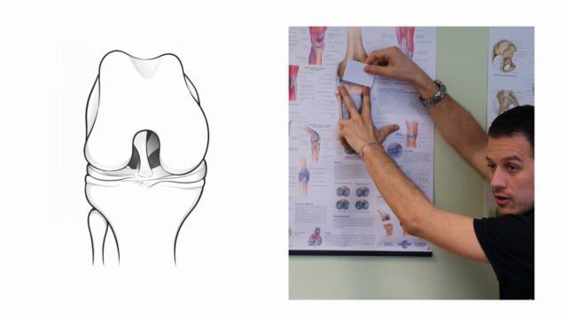 The stiff knee after injury or surgery - how to manage it - Screenshot_02