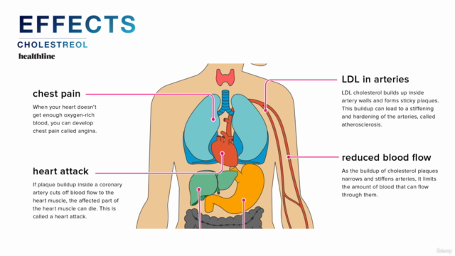 Master Class on Cholestrol and Its Effects TM - Screenshot_02