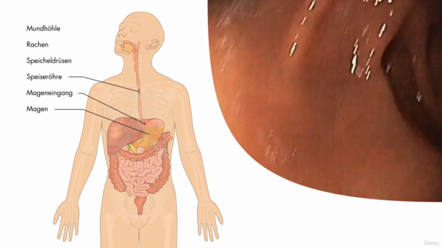 Anatomie, Physiologie & Pathologie des Verdauungssystems - Screenshot_04